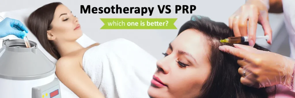 which is better mesotherapy or prp