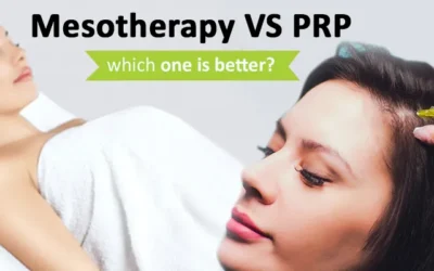 Mesotherapy vs PRP which one is better?