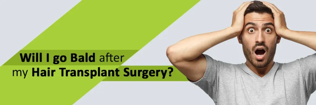 will I go bald after hair transplant surgery