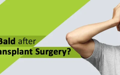 Will I go Bald after my Hair Transplant Surgery?