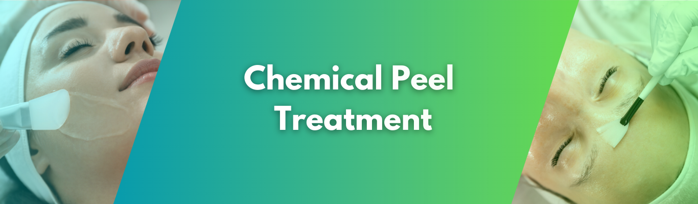 Chemical Peel Treatment