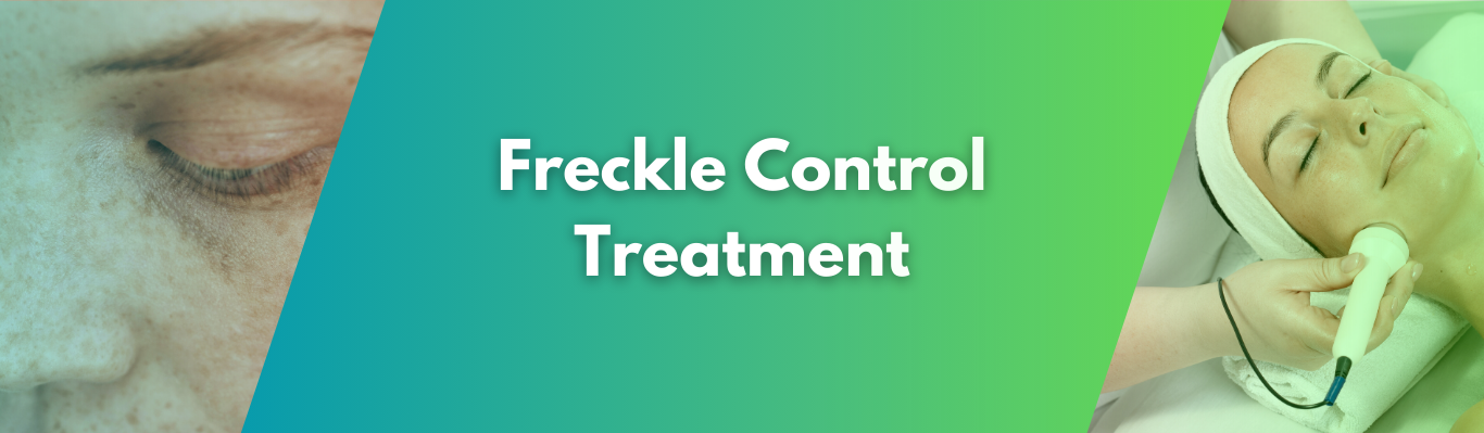 Freckle Control Treatment
