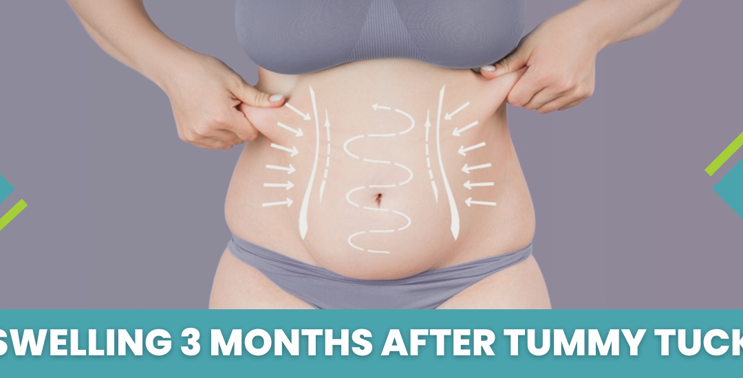 Swelling 3 months after tummy tuck