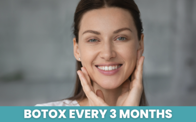 Botox Every 3 Months