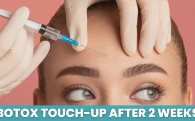 Botox Touch-Up After 2 Weeks: The Perfect Timing Explained