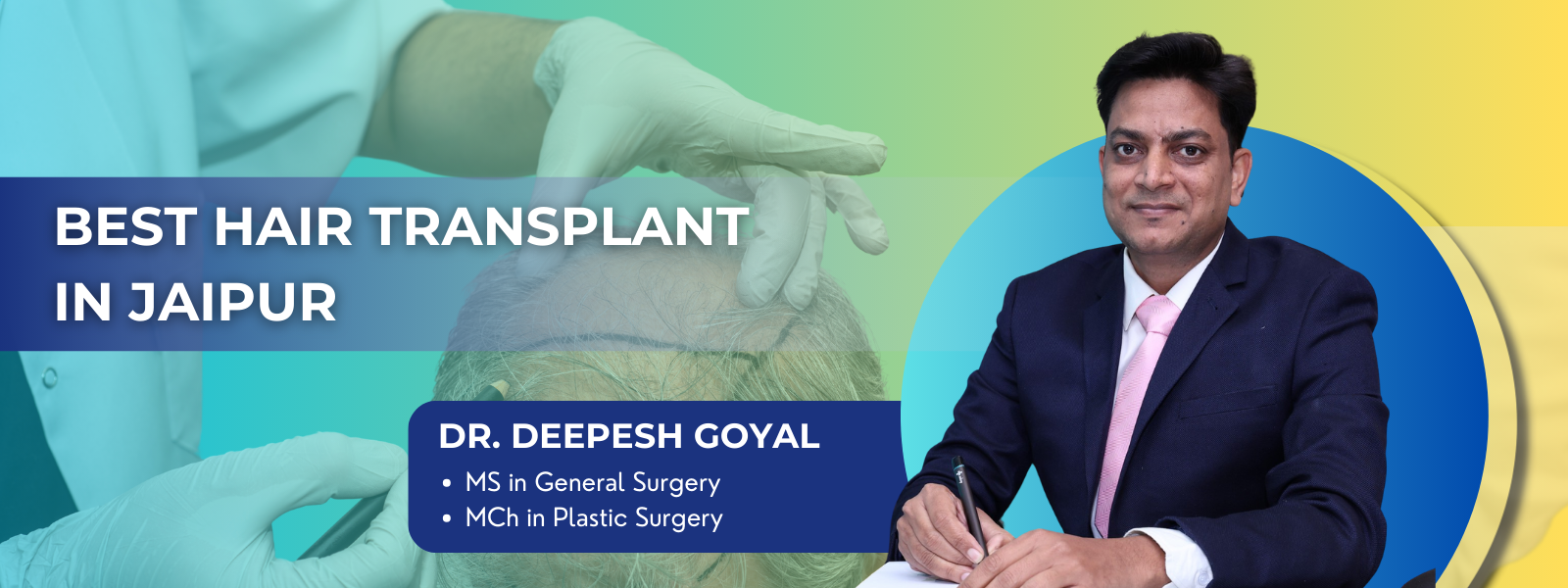 Best Hair Transplant