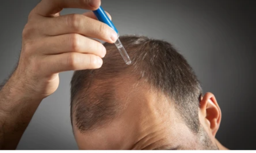 How to Take Care of Your Scalp During the Shedding Phase