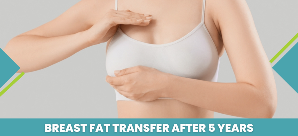 Breast Fat Transfer After 5 Years