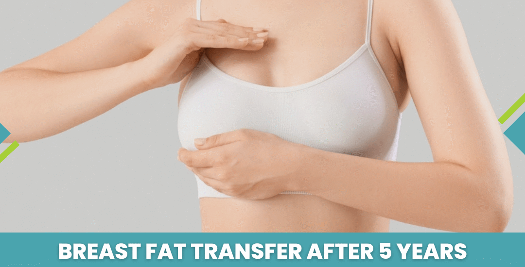 Breast Fat Transfer After 5 Years
