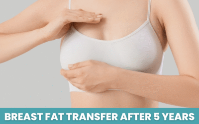 Breast Fat Transfer After 5 Years