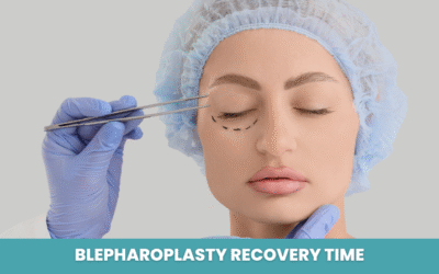 Blepharoplasty Recovery Time