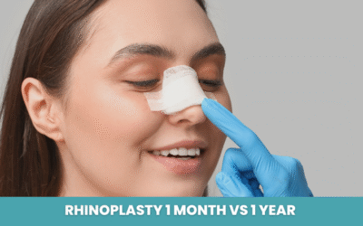 Rhinoplasty 1 Month vs 1 Year: What to Expect