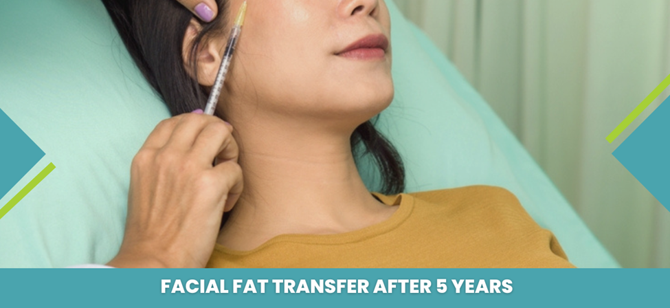 Facial Fat Transfer After 5 Years