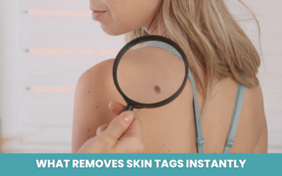 What Removes Skin Tags Instantly — Expert Advice from a Cosmetic Surgeon