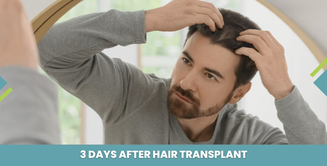 3 Days After Hair Transplant: Healing, Care & What’s Normal