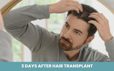 3 Days After Hair Transplant: Healing, Care & What’s Normal
