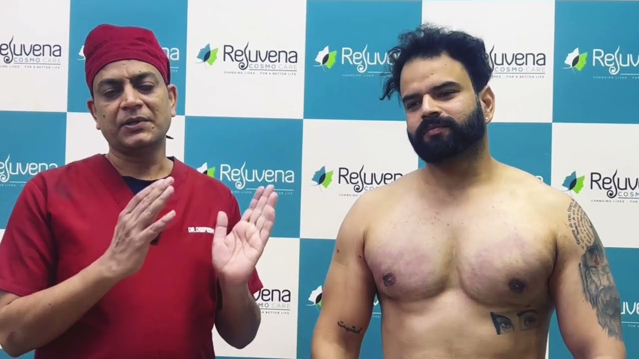 Gynaecomastia surgeon in Jaipur