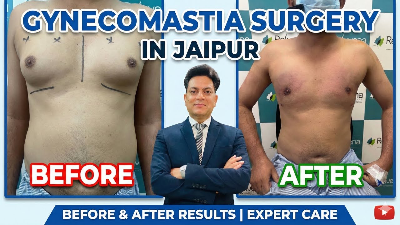 Gynaecomastia surgeon in Jaipur