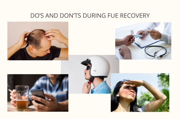 Do's & Don'ts during FUE recovery-Rejuvena