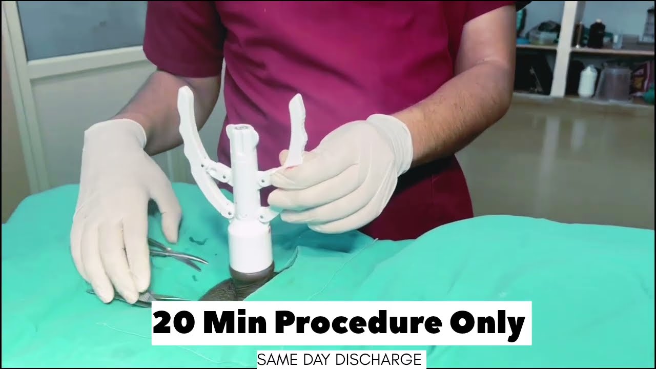 ZSR Circumcision in Jaipur