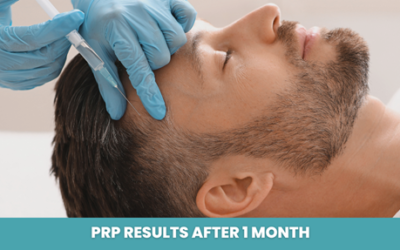 PRP Results After 1 Month