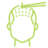 FUE Hair Transplant Technique Icon - Rejuvena Cosmo Care Jaipur