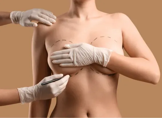 imgi_6_breast_aug | Rejuvena Cosmetic Breast Augmentation Surgery in Jaipur - Natural Results by Cosmetic Surgeon