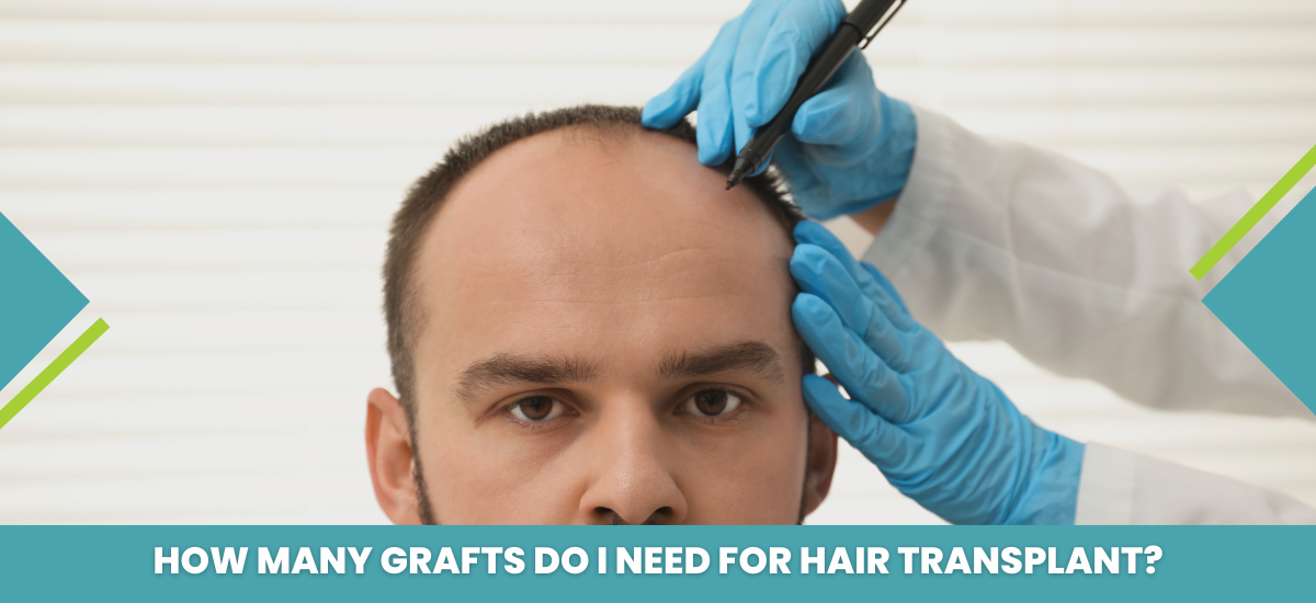 Hair transplant 1 month progress - scalp healing and recovery at Rejuvena Cosmo Care Jaipur