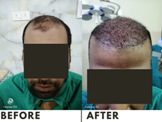 Picture14 | Rejuvena Cosmetic