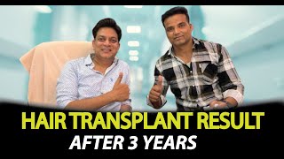 1jNRGewKnPs-MQ TIs Hair Transplant Painful