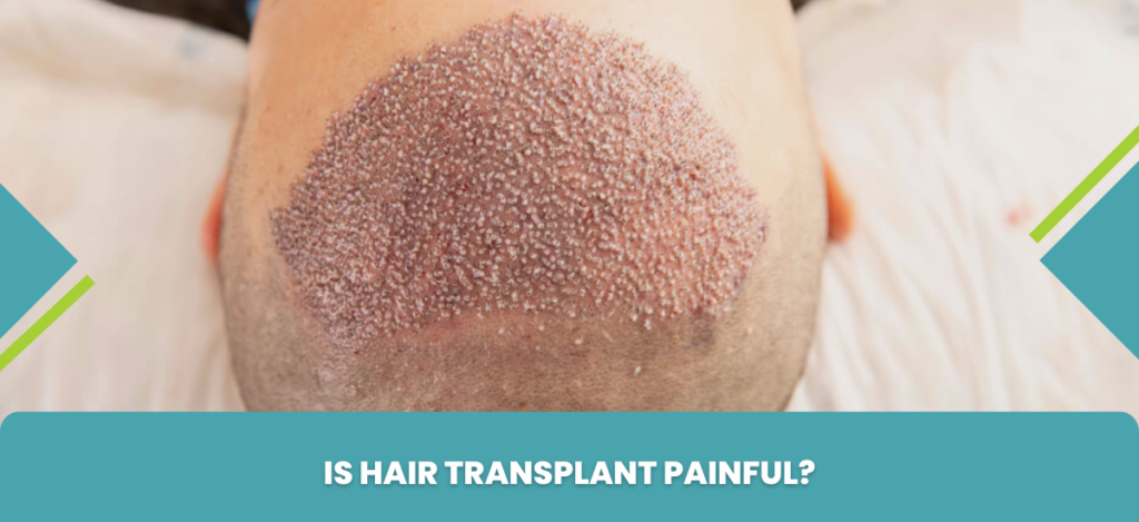 Is Hair Transplant Painful