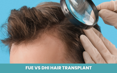 FUE vs DHI Hair Transplant: Which Technique Is Right for You?