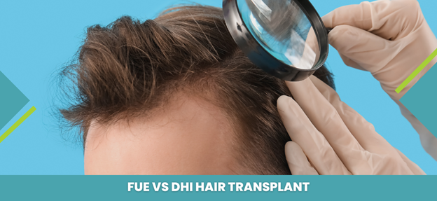 Hair Transplant Hairline Design