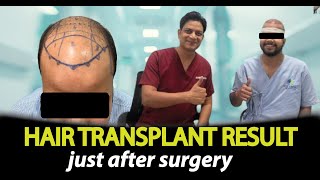 z8iETDyV_w8-MQ Clinic scene with a patient showing scalp markings after hair transplant; two doctors give thumbs up; overlay text reads 'HAIR TRANSPLANT RESULT just after surgery'.